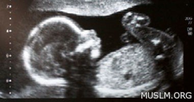  10 signs warn you of the importance of screening sonar to make sure the health of the fetus 